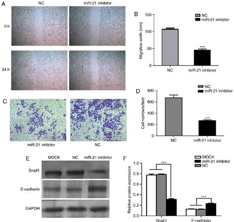 Effects Of Mir On Sacc Lm Migration And Invasion A Sacc Lm Cell