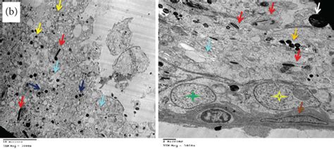 A Electron Micrograph Of Testes Of The Control Group Showing Normal Download Scientific