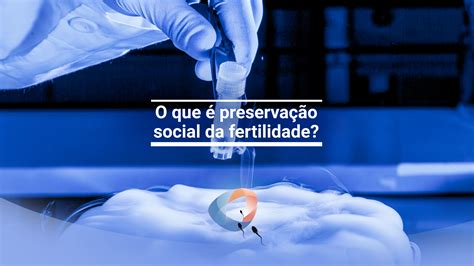 O que é preservação social da fertilidade Dr Augusto Bussab