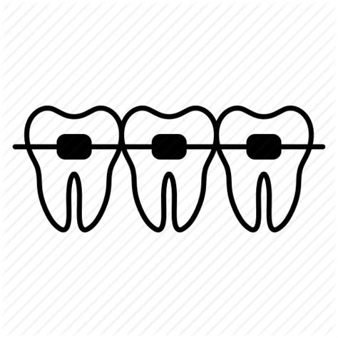 Braces Clipart Braces Transparent Free For Download On Webstockreview 2025