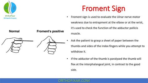 Ulnar Nerve Entrapment Test