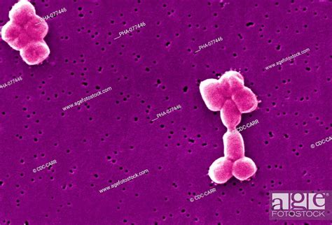 Acinetobacter Gram Stain