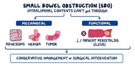 Small bowel obstruction: Clinical sciences - Osmosis Video Library