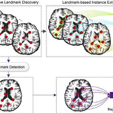 Pdf Landmark Based Deep Multi Instance Learning For Brain Disease