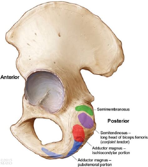 Figure 1 From Anatomy Of The Adductor Magnus Origin Semantic Scholar