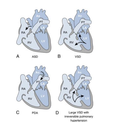 Path 12 Heart Flashcards Quizlet