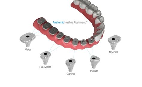 Healing Abutment MegaGen