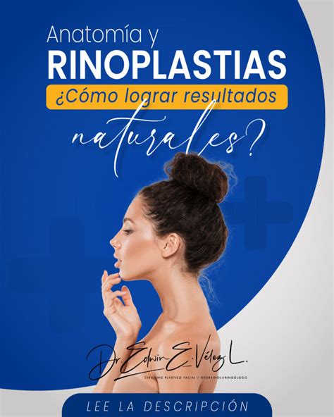 Anatom A Y Rinoplastias C Mo Lograr Resultados Naturales Doctor