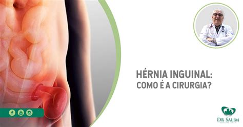 H Rnia Inguinal Como A Cirurgia Dr Salim Crm Sp