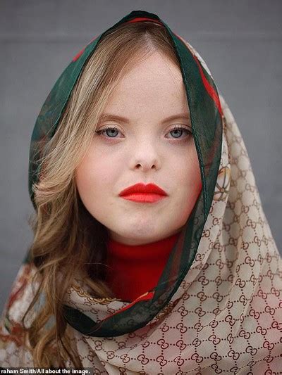 Penampilan Cantik Wanita Down Syndrome Yang Dikontrak Jadi Model