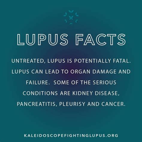 Lupus Flares Recognizing One Triggers And Prevention Artofit