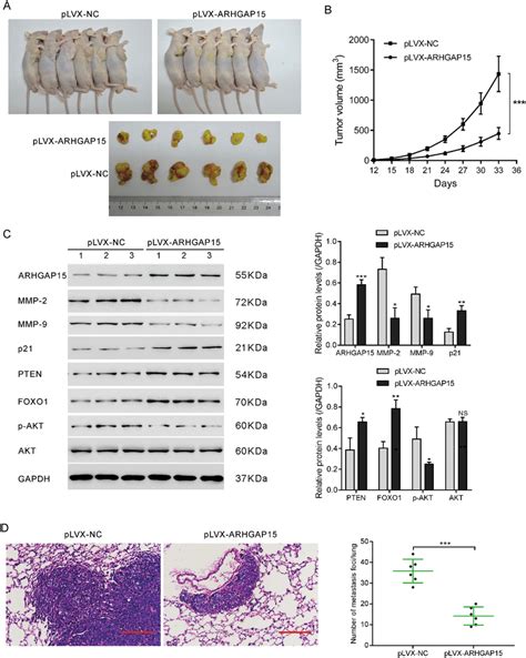 Arhgap Hyperexpression Suppressed The Formation And Distant