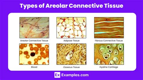 Areolar Tissue Functions Common Diseases And Conditions Of Areolar Tissue Difference Between