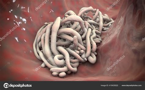 Parasitic Worms Lumen Intestine Illustration Ascaris Lumbricoides Other