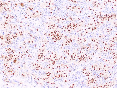 prame antibody recombinant antibody zeta corporation