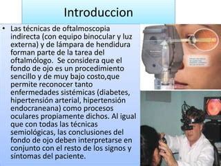 Examen Del Fondo De Ojo PPT