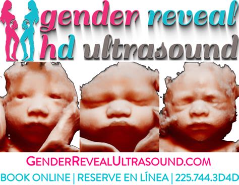 Gender Reveal HD 3D 4D Ultrasound | Prairieville, La