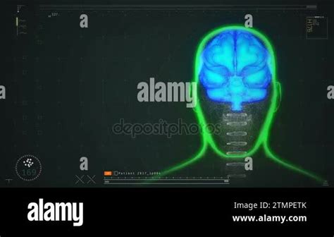 Patient's brain scan test results on screen, disease diagnostics and prevention Stock Video ...