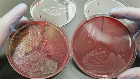 Microbiology Gpc Gnc Gncb Colonial Growth On Bap And Choc Youtube