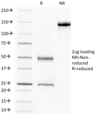 HCG-beta (Pregnancy and Choriocarcinoma Marker) Monoclonal Antibody ...