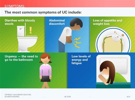 Risk Factors & Clinical Manifestations - ULCERATIVE COLITIS