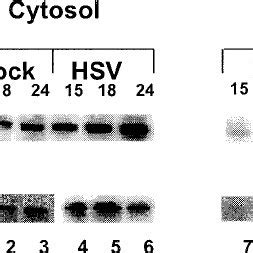 HSV 1 Infection Induces Nuclear Translocation Of NF B And