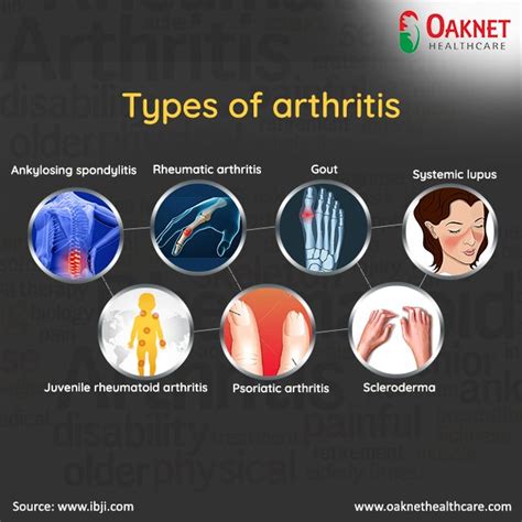 Complete List Of Arthritis Types