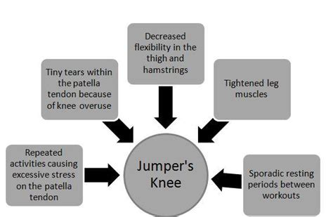 Jumper’s Knee – The Symptoms And Treatment | HPFY