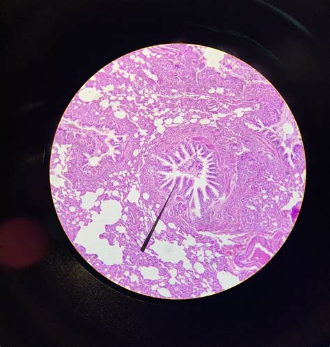 Lung Histology Diagram Quizlet