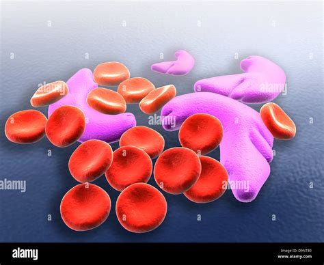 Sickle Cell Disease Hi Res Stock Photography And Images Alamy