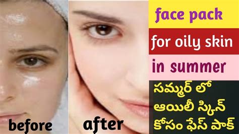 ఆయిలీ స్కిన్ వాళ్ళ కోసం ఫేస్ పాక్ Face Pack For Oil Skin Summer Skin