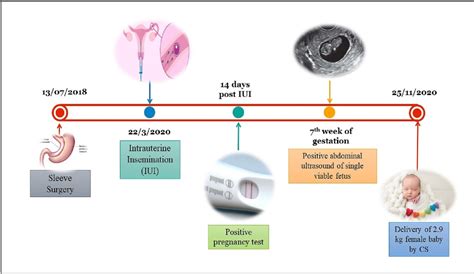 Figure From Successful Pregnancy Following Gastric Sleeve Surgery For