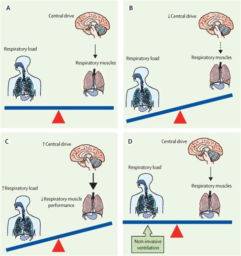 Geburt Gastgeber von Diplom ventilation invasive Motiv Briefumschlag ...