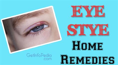 Eye Stye Home Remedies | Eye Care | Health Getinfopedia