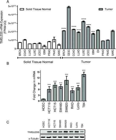 Timeless Is Overexpressed In Cancer A Timeless Mrna Expression Download Scientific Diagram