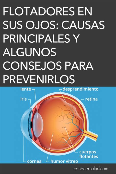 Flotadores En Sus Ojos Causas Principales Y Algunos Consejos Para