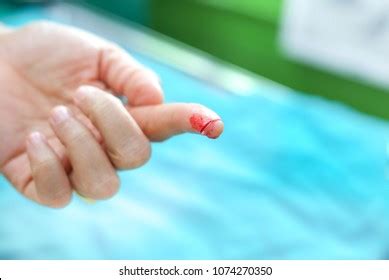 Cut My Finger Accident Injury Bleeding Stock Photo 1074270350