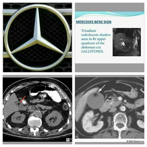 Pin By Natalie Adams On Rad Pathology In 2023 Medical Radiography