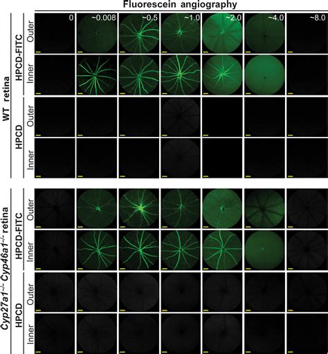 2‐hydroxypropyl‐β‐cyclodextrin Reduces Retinal Cholesterol In Wild‐type