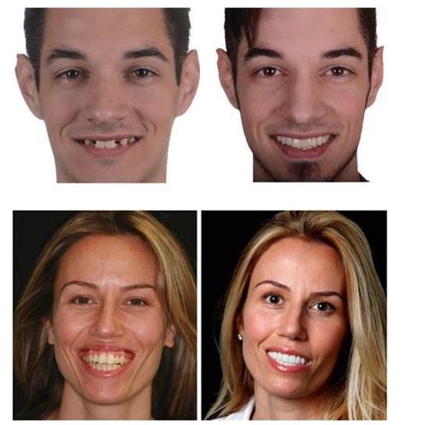 Get the most amazing confident and perfect smile with this secret ...