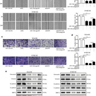 Mir B Suppressed Migration Invasion And Emt Process Of Escc Cells