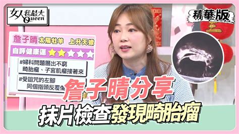 詹子晴分享 健康狀況接”腫”而來 抹片檢查發現畸胎瘤 女人我最大 20230113 Youtube