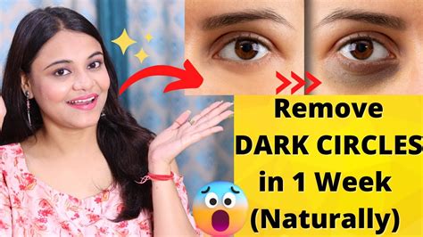 Remove Dark Circles In 7 Days Naturally At Home 100 Results Bella