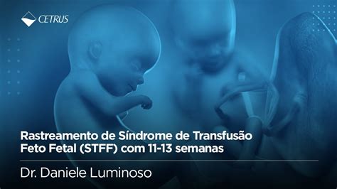 Sindrome De Transfus O Feto Fetal