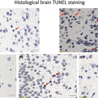 Offspring neuronal TUNEL staining in Groups 1‐5. Histological brain ...