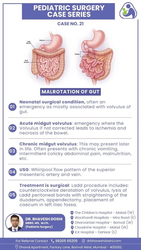 malrotation  gut