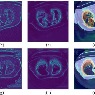 left  righta    views   ct scan feature maps