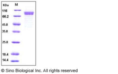 Sino Biological Human Cadherin 8 CDH8 Protein His Tag 50ug