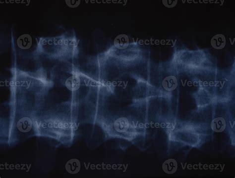 X-ray image of the spine for medical diagnosis 12957774 Stock Photo at Vecteezy