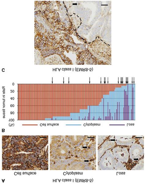 Expression Pattern Of Human Leukocyte Antigen Hla Class I Molecules